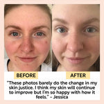 Travel-Size Skincare Bundle