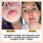 Face Moisturizer with Vitamin E - Travel Size