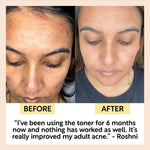 Face Toner with Hyaluronic Acid - Travel Size